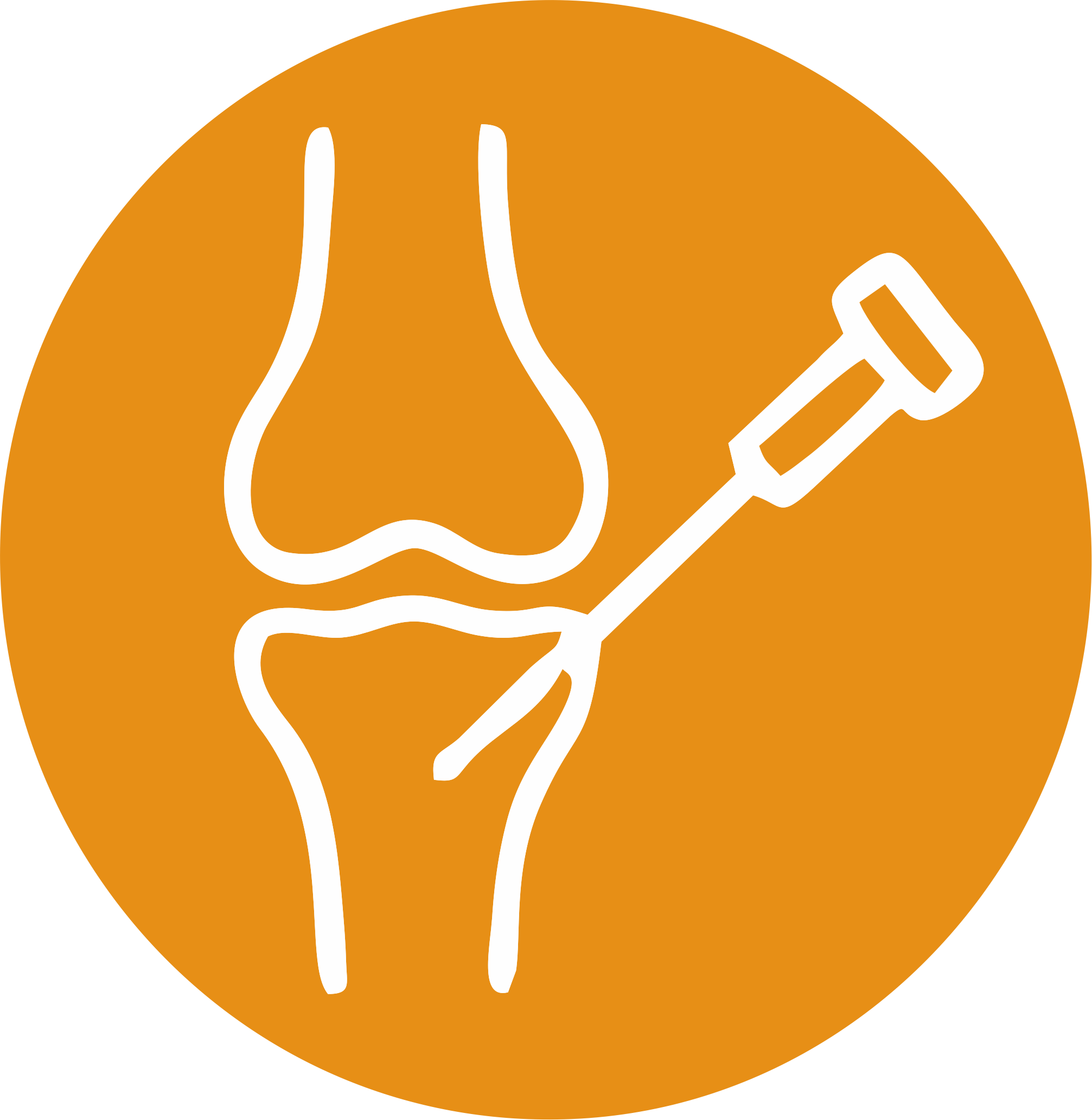 Joint Replacement & Sports Injury